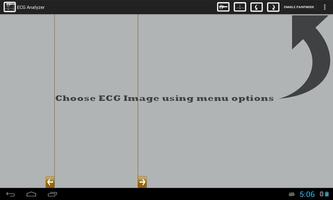 ECG Analyzer capture d'écran 3