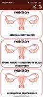 Gynecology 포스터