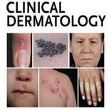 Clinical Dermatology