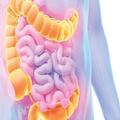 Colorectal Cancer