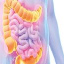 Colorectal Cancer APK