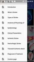 پوستر Stroke
