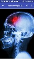 برنامه‌نما Stroke عکس از صفحه
