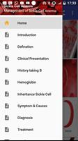 Sickle Cell Anemia poster