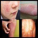 Skin Diseases APK