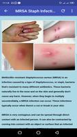 Skin Diseases captura de pantalla 2