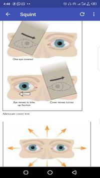 Ophthalmology Guide 截图 1