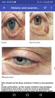 Ophthalmology Guide Screenshot 2