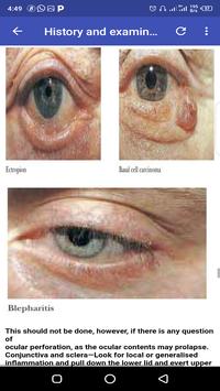 Ophthalmology Guide 截图 2