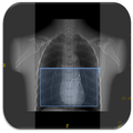 CT Scan Technique