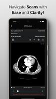 NeuroView পোস্টার