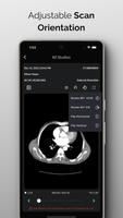 NeuroView স্ক্রিনশট 2