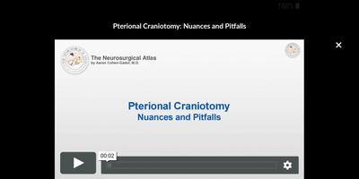 The Neurosurgical Atlas screenshot 3