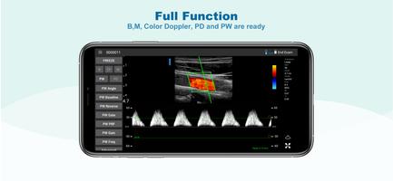 uREzpocus captura de pantalla 1