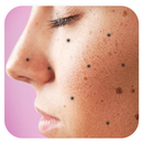 Get Rid Dark Spots On Face APK