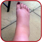 SWOLLEN FEET HOME REMEDIES icon