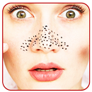 Blackhead Removal Remedies APK