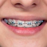 Braces Ideas plakat