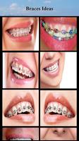 Braces Ideas screenshot 2