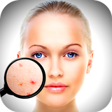 Face Enhancer: Blemish Remover