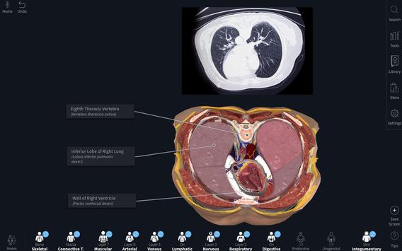 Complete Anatomy 2020 Price Complete Anatomy 2020 Price