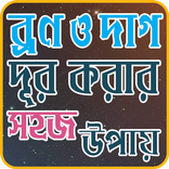 ব্রণ দূর করার উপায়