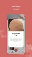 Side Onco Skin syot layar 3