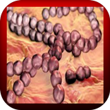 Streptococcus