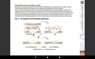 Antithrombotic Therapy Handbook screenshot 2