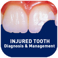 Injured Tooth – Trauma Guide