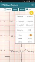 ECG Live Capture स्क्रीनशॉट 3