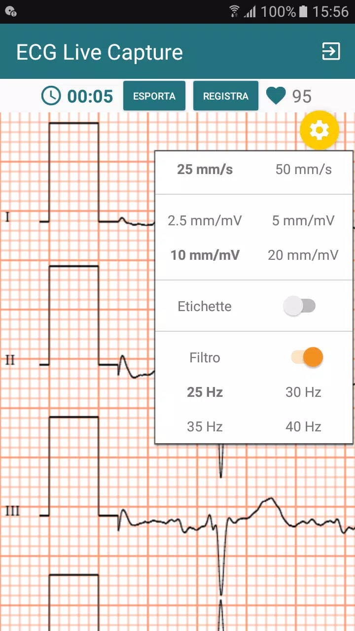 ECG Live Capture APK for Android Download