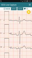 ECG Live Capture स्क्रीनशॉट 2