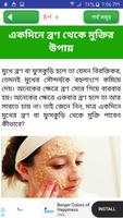 beauty tips or ব্রণ দূর করার উ screenshot 3