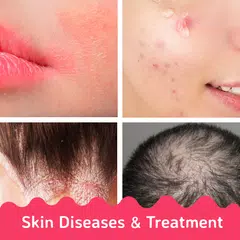 Skin Diseases and Treatments APK Herunterladen