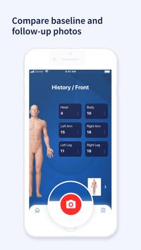 AI Dermatologist 截图 3