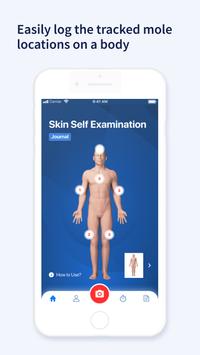 AI Dermatologist 截图 2
