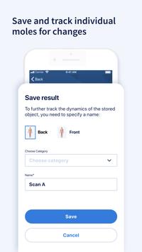 AI Dermatologist 截图 5