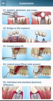 Dental 3D Illustrations syot layar 2