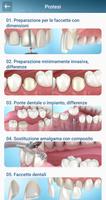 1 Schermata Illustrazioni dentali