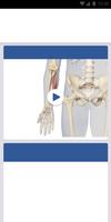 3D Spasticity Ekran Görüntüsü 3