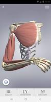 3D Spasticity poster