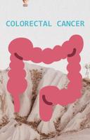 Colon Cancer پوسٹر