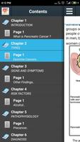 Pancreatic Cancer screenshot 3