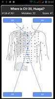 Points Acupuncture Corps Quiz capture d'écran 1