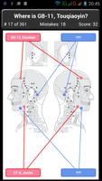 Points Acupuncture Corps Quiz capture d'écran 2