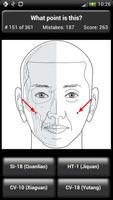 Points d'Acupuncture Quiz capture d'écran 1