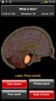 Anatomie Quiz capture d'écran 3