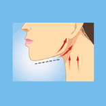 How to remove a double chin