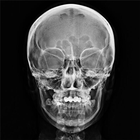 xray Zeichen